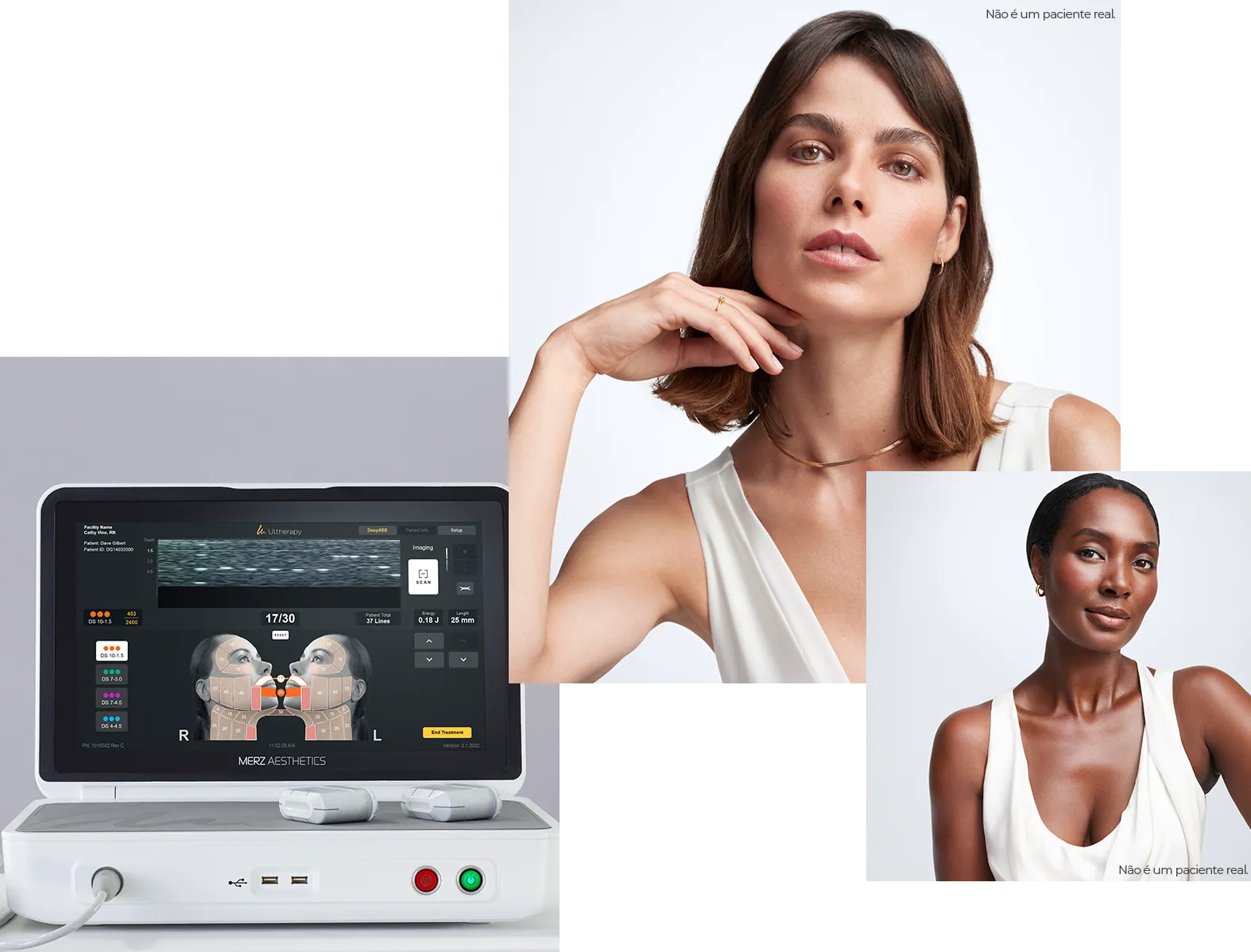 Colagem com a unidade de controle do dispositivo Ultherapy PRIME&reg; e duas mulheres (não são pacientes reais).