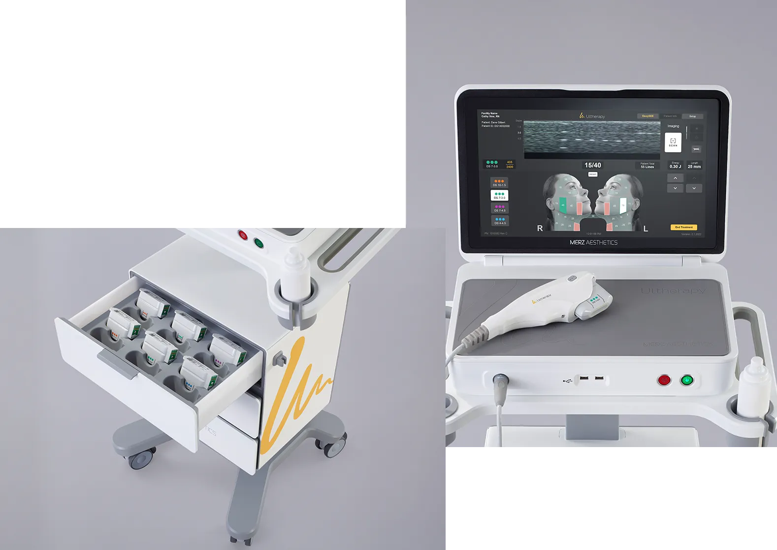Imagem em duas partes mostrando a gaveta do dispositivo Ultherapy<sup>&reg;</sup> com os transdutores e a parte superior com a unidade de controle e a peça de mão.