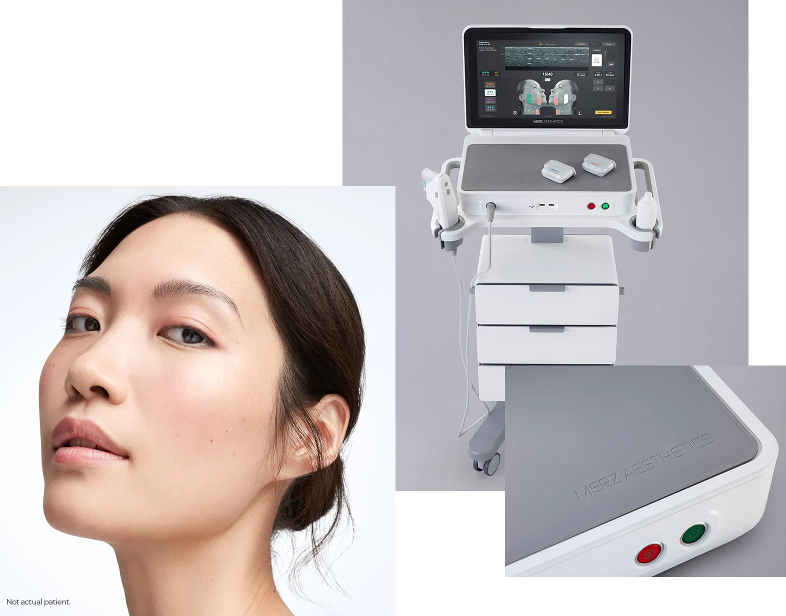 Colagem do rosto de uma mulher, o dispositivo completo Ultherapy PRIME<sup>&reg;</sup> e um close-up de seus botões.