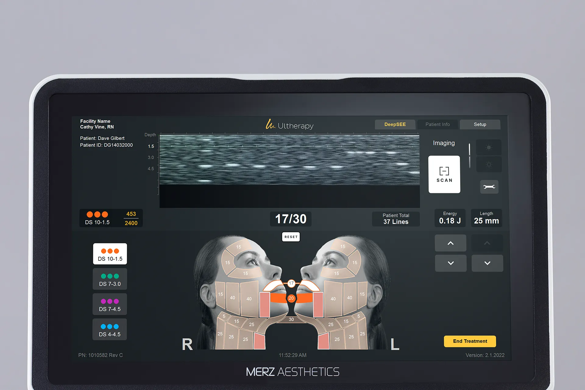 Monitor do Ultherapy PRIME® com tecnologia de imagem nítida para tratamentos precisos, personalizados e consistentes.