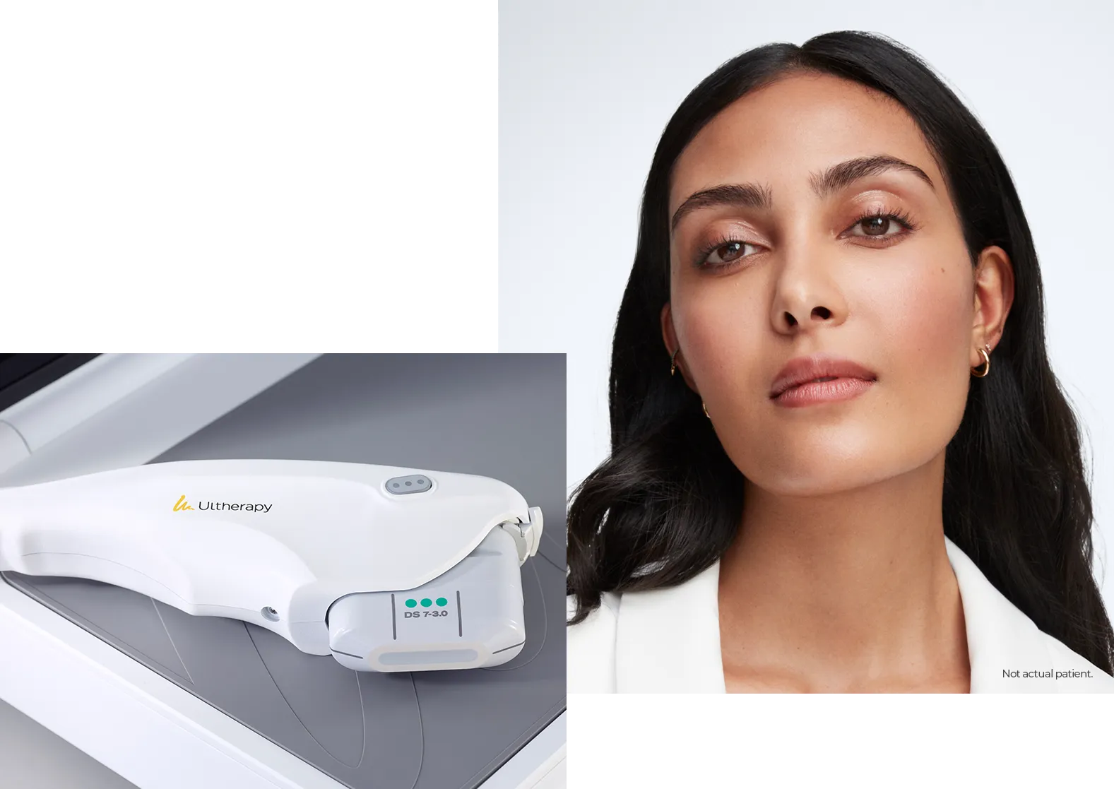 Close-up da peça de mão do Ultherapy PRIME<sup>&reg;</sup> ao lado de uma modelo (não é uma paciente real).