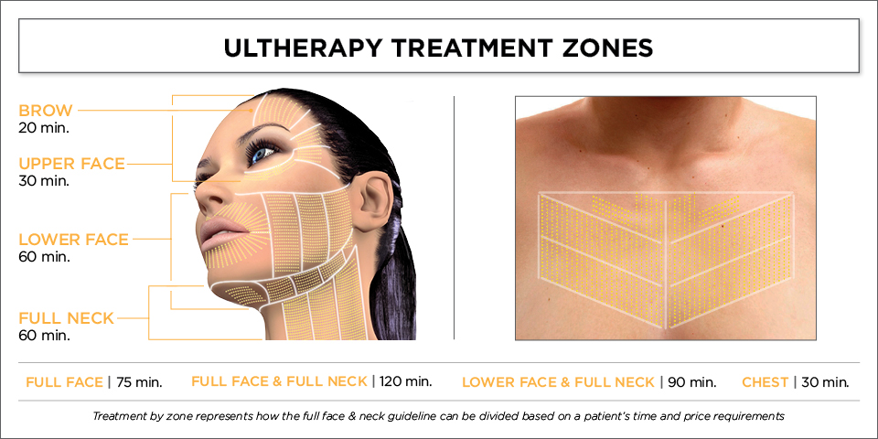 Ultherapy Support